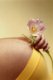 Лицевое предлежание. Положение плода в утробе матери, влияющее на ход и способ родов.