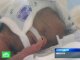 Иркутские врачи борются за жизнь уникального младенца.