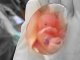 Человеческий эмбрион