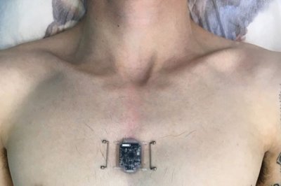 Новосибирский программист установил себе компас-имплант
