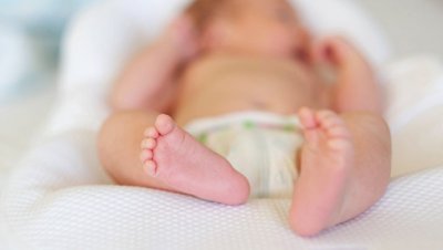 В Индии родился младенец, "беременный" собственным братом