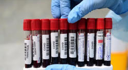 Число случаев коронавируса в Португалии достигло 32,7 тысячи