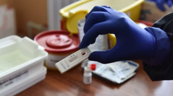 На Украине выявили 829 новых случаев заражения коронавирусом