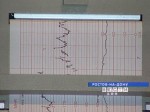 Врачи Ростовского областного кардиоцентра провели выездные обследования