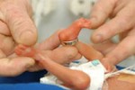 Британские врачи не будут спасать сильно недоношенных младенцев
