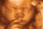Ученые признали движения нерожденных младенцев целенаправленными