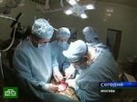 Отечественная трансплантология празднует юбилей