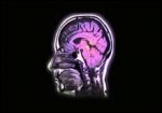 Лекарство от бессонницы восстанавливает поврежденный мозг